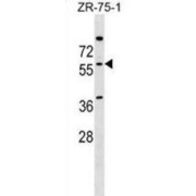 NOVA Alternative Splicing Regulator 2 (NOVA2) Antibody