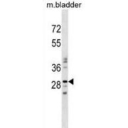 Nucleotide Binding Protein Like (NUBPL) Antibody