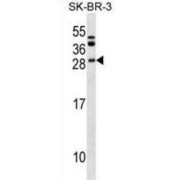 B-Cell CLL/lymphoma 7 Protein Family Member C (BCL7C) Antibody