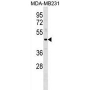 One Cut Domain Family Member 3 (ONECUT3) Antibody