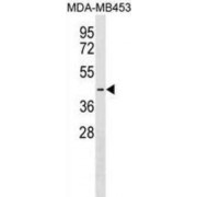 Pejvakin (PJVK) Antibody