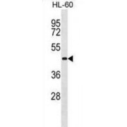 Ubiquitin-Like-Conjugating Enzyme ATG3 (ATG3) Antibody