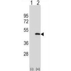 Ubiquitin-Like-Conjugating Enzyme ATG3 (ATG3) Antibody