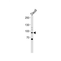 Signal Transducer And Activator of Transcription 3 (STAT3) Antibody