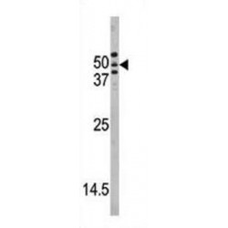 Cysteine Protease ATG4A (ATG4A) Antibody