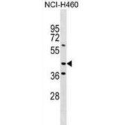 Meis Homeobox 3 (MEIS3) Antibody