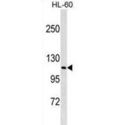 M-Phase Phosphoprotein 9 (MPHOSPH9) Antibody