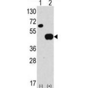 Autophagy Related 4B Cysteine Peptidase (ATG4B) Antibody