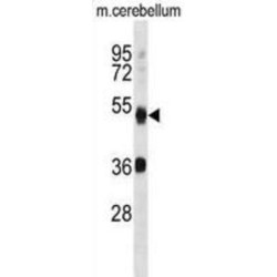 Autophagy Related 4B Cysteine Peptidase (ATG4B) Antibody