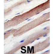 Autophagy Related 4B Cysteine Peptidase (ATG4B) Antibody