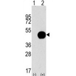 Autophagy Related 4B Cysteine Peptidase (ATG4B) Antibody