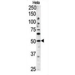 Autophagy Related 4C Cysteine Peptidase (ATG4C) Antibody