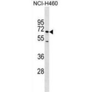 E-Selectin / CD62E (SELE) Antibody