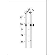 Western blot analysis of LNCap (Lane 1) and PC-3 (Lane 2) whole cell lysates (20 µg per lane) using Dentin Sialophosphoprotein Antibody (1/2000 dilution) followed by Goat Anti-Rabbit IgG H+L (1/10000 dilution), with 5% NFDM/TBST for blocking.