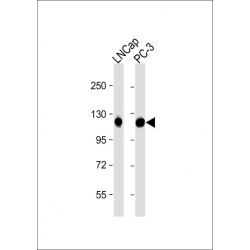 Dentin Sialophosphoprotein (DSPP) Antibody