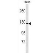 GTF2I Repeat Domain Containing 1 (GTF2IRD1) Antibody