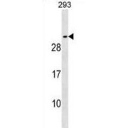 Synaptosomal-Associated Protein 25 (SNAP25) Antibody