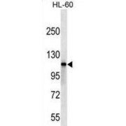 Serine/threonine-Protein Kinase SIK2 (SIK2) Antibody