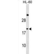 Interferon Type A1/A2 (IFNA1) Antibody