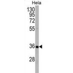 Autophagy Protein 5 (ATG5) Antibody