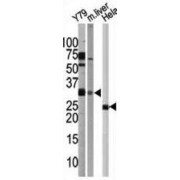 Autophagy Protein 5 (ATG5) Antibody