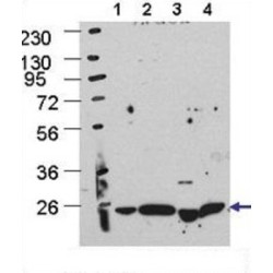 Autophagy Protein 5 (ATG5) Antibody