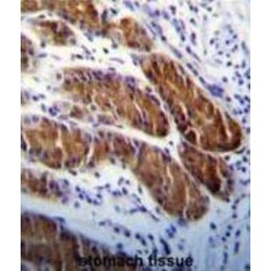 Autophagy Protein 5 (APG5) Antibody