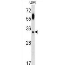 Autophagy Protein 5 (APG5) Antibody