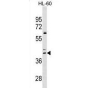 C-C Chemokine Receptor Type 4 (CCR4) Antibody