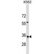 Hydroxymethylglutaryl-CoA Lyase, Mitochondrial (HMGCL) Antibody