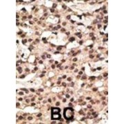 Autophagy Related 9A (ATG9A) Antibody