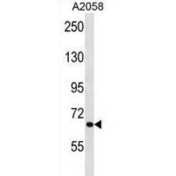 Autophagy Related 9A (ATG9A) Antibody