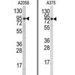 Autophagy Related 9A (ATG9A) Antibody