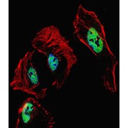 Retinoic Acid Receptor Beta (RARB) Antibody