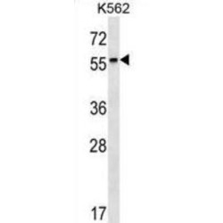 Retinoic Acid Receptor Beta (RARB) Antibody