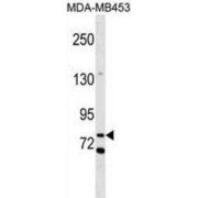 Western blot analysis of MDA-MB453 cell lysates using Collectin 12 (COLEC12) Antibody.