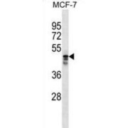 Mu-2-Related Death-Inducing Protein (MUDEN) Antibody