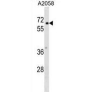 PYRD2 Antibody