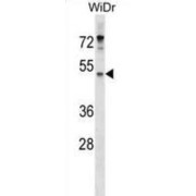 Ectonucleotide Pyrophosphatase/Phosphodiesterase 4 (ENPP4) Antibody