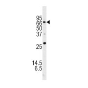 Autophagy-Related Protein 16-1 (ATG16L) Antibody