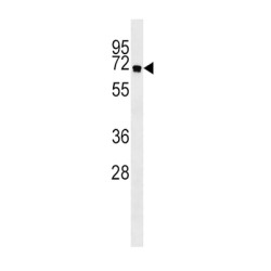 Autophagy-Related Protein 16-1 (ATG16L) Antibody