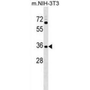 Coiled-Coil Domain-Containing Protein 75 (CCDC75) Antibody