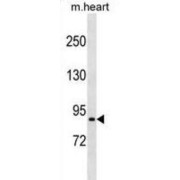 Proline-Rich Transmembrane Protein 4 (PRRT4) Antibody