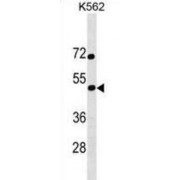 Calcium-Responsive Transactivator (SS18L1) Antibody