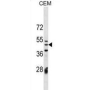 Izumo Sperm-Egg Fusion Protein 1 (IZUM1) Antibody