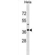 Golgi Phosphoprotein 3-Like (GOLPH3L) Antibody