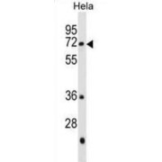 Polypeptide N-Acetylgalactosaminyltransferase 13 (GALNT13) Antibody