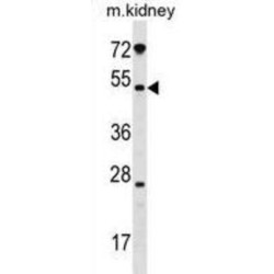 Polypeptide N-Acetylgalactosaminyltransferase 13 (GALNT13) Antibody