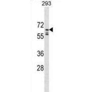 RING-type E3 Ubiquitin Protein Ligase PPIL2 (PPIL2) Antibody