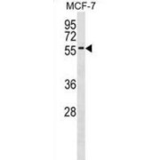 Zinc Finger Protein 787 (ZNF787) Antibody